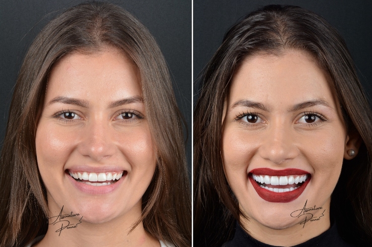 Foto: Reprodução/Rogério Penna/Leo Dias