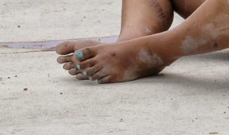 Homem trans foi morto com tiros no rosto / Foto: Jander Robson / Portal do Holanda