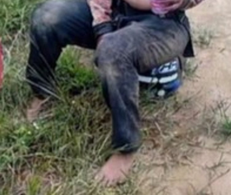 Vítima ficou em estado grave - Foto: Divulgação 