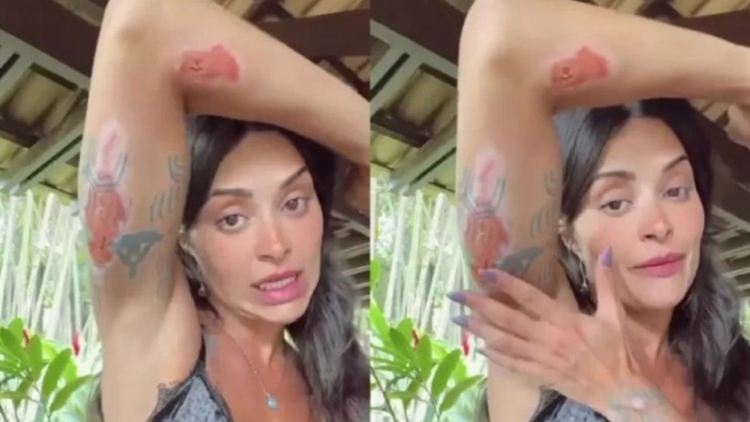 Aline Campos sofreu acidente de moto em Bali - Imagens: Reprodução/Instagram