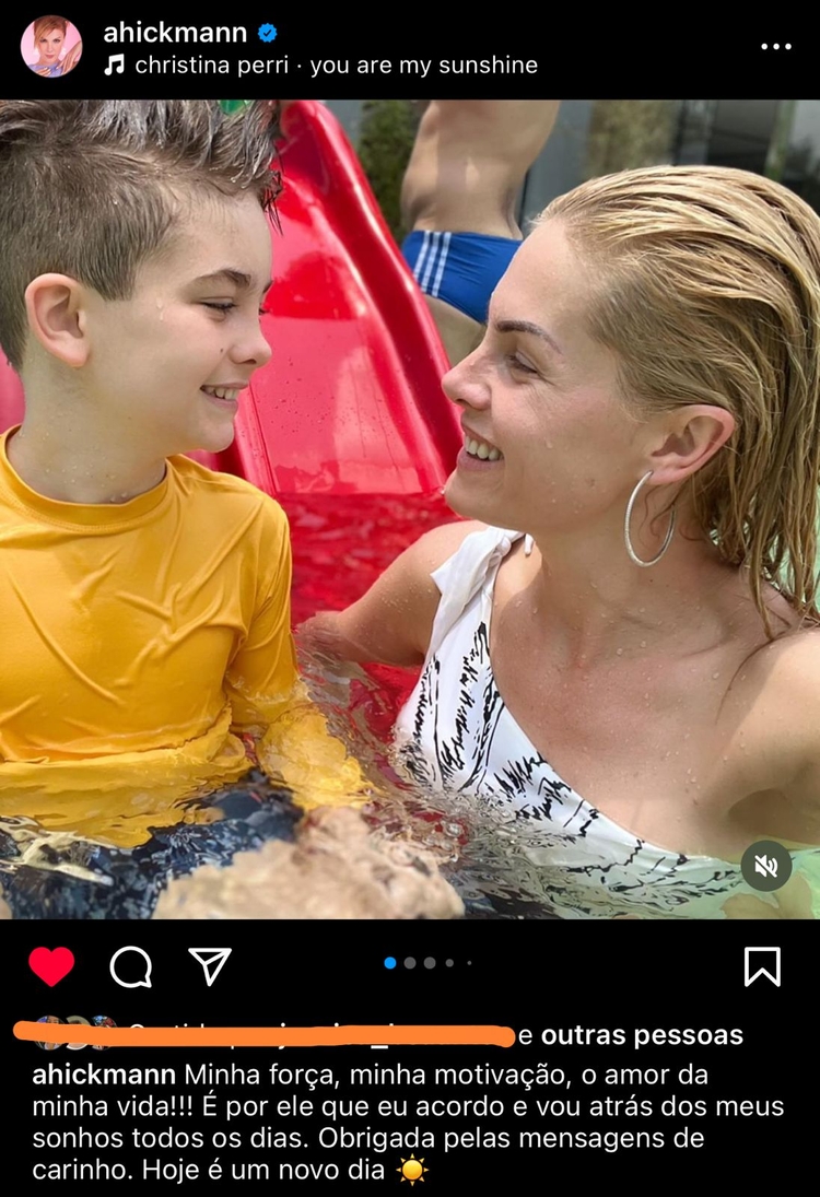 Ana Hickmann agradece mensagens de apoio após agressão - Foto: Reprodução/Instagram