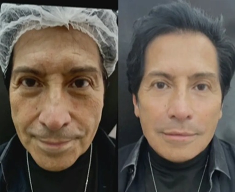 Antes e depois do mágico Mister M - Fotos: Divulgação/SBT