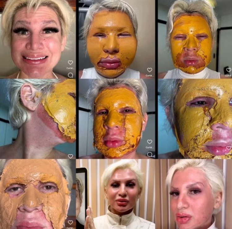 Imagens: Reprodução/Instagram