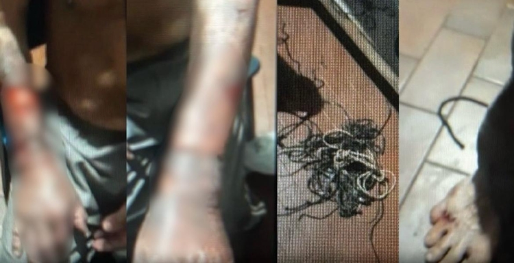 Vítima sofreu ferimentos / Foto: Divulgação/PC-AM