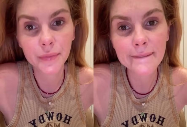 Foto: Reprodução Instagram