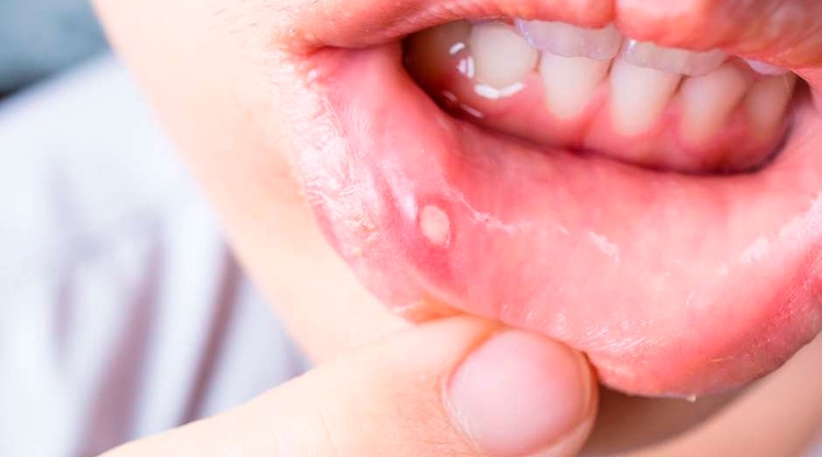 Foto: Reprodução / Especialistas explicam riscos