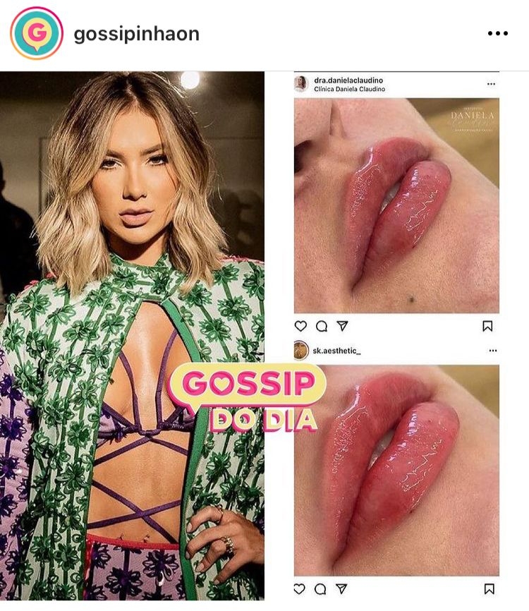Foto: Reprodução/Instagram Gossip do Dia