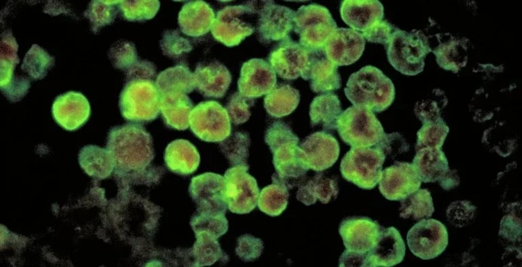 Foto: CDC/ Dr. Govinda S. Visvesvara