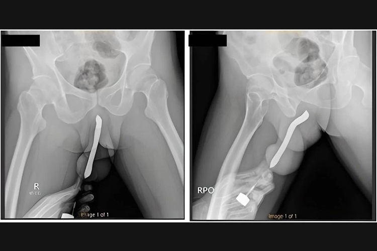 Foto: Hospital Geral Acadêmico Soetomo/ Divulgação