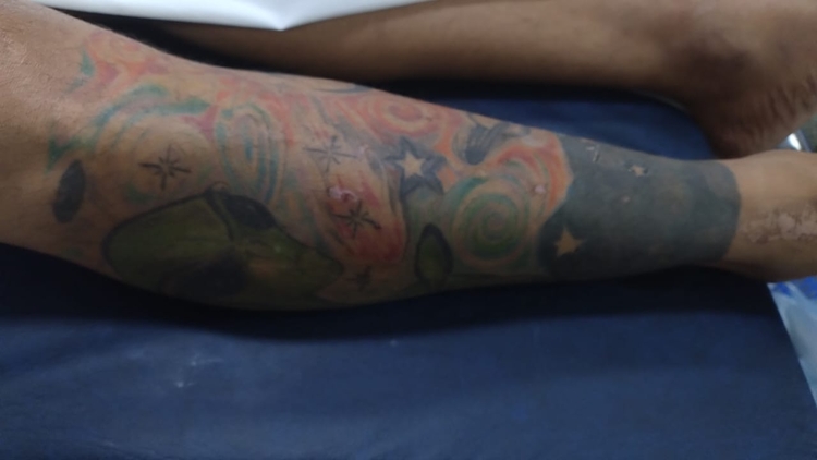 Foto: Divulgação SES-AM