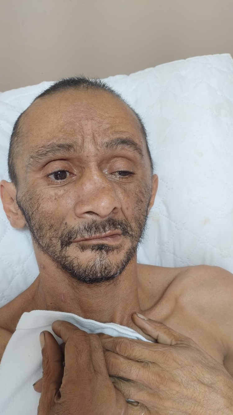 Paciente Ricardo da Silva Teles internado no Hospital João Lúcio. - Foto: Divulgação SES-AM
