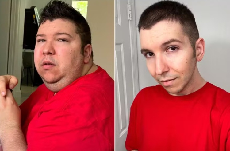 Antes e depois de Nikocado Avocado - Foto: Reprodução/Instagram 