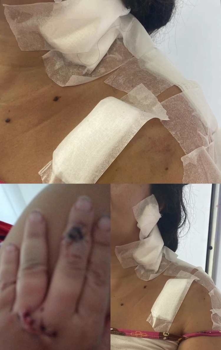 Foto: Reprodução/Instagram @alecampelo