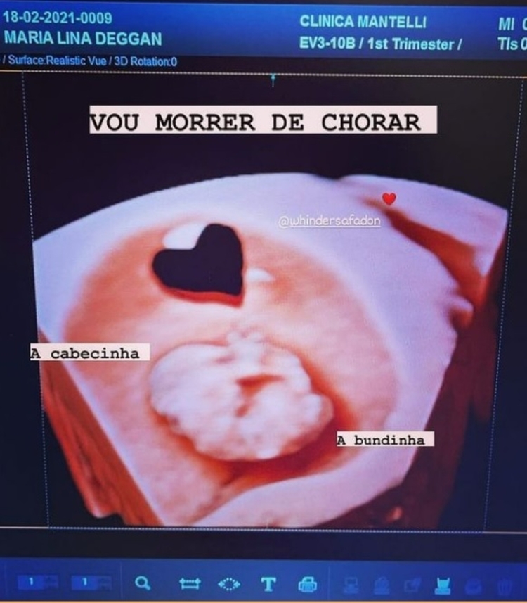 Foto: Reprodução/Instagram