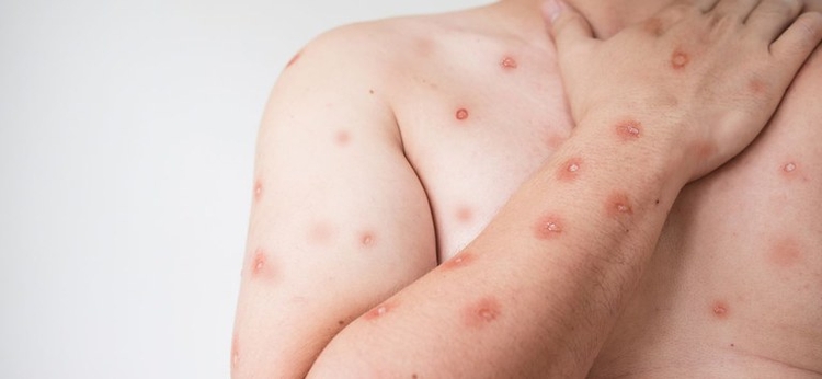 Prefeitura fez alerta - Foto: Divulgação 