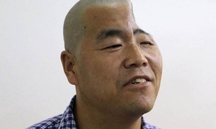 Chinês tem o crânio reconstituído com a ajuda de uma impressora 3D