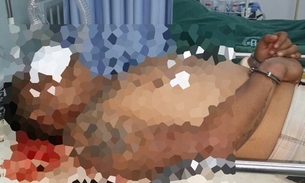 Homem é atropelado depois de assalto à mão armada 