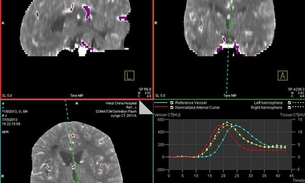 Software livre ajuda a gerenciar dados na área de neurociência