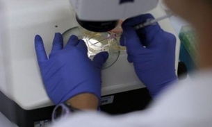 Cientistas produzem células-tronco embrionárias a partir da pele humana