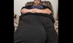 Homem com testículos de 35 quilos pede ajuda para não perder mulher