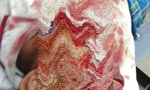 Faca é cravada no rosto de homem que brigava com a namorada