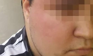 Jovem espancada por ser lésbica e usar barba