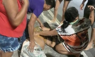 Em Manaus, homem tem perna quebrada ao ser atropelado por motociclista embriagado