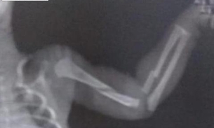 Mãe confessa que espancou bebê de dois meses e o pior acontece 