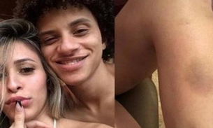 Ex-namorada de Gabriel do Borel diz que foi agredida a 'bicudas'