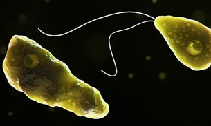 Caso incomum de ameba que destrói cérebro é confirmado na América