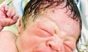 Saiba a verdade sobre o bebê que nasceu segurando um DIU