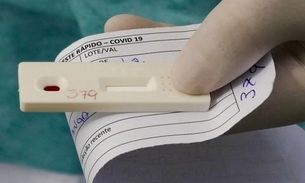 ANS retira teste para covid-19 de lista obrigatória de cobertura de planos de saúde