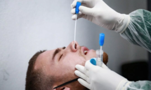 Chapecoense anuncia mais dez casos de covid-19 e totaliza 26