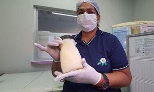 Campanha faz coleta de frascos para armazenar leite humano