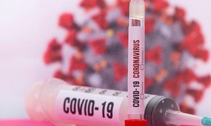 Brasil ultrapassa 93 mil mortes por Covid-19