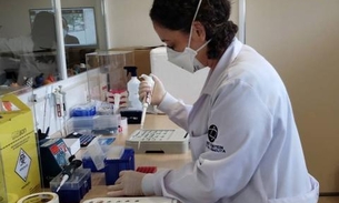 Amazonas recebe mais 2 mil testes para diagnóstico da Covid-19 doados pela Petrobras