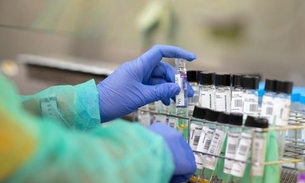 Vacina contra Covid-19 pode ter registro em outubro, diz Butantan