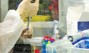 Brasil passa das 107 mil mortes pela covid-19 e tem alto número de novos casos