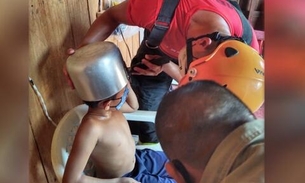 Criança entra em desespero ao ficar com cabeça presa em panela no Amazonas