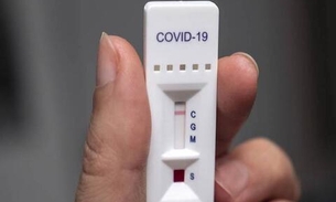 Mais de 160 profissionais de educação com Covid-19 no Amazonas