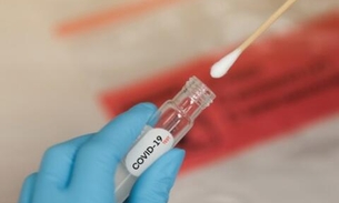 Bélgica e Holanda registram casos de reinfecção por coronavírus