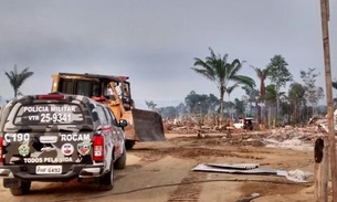 Com 85% do corpo queimado, morre homem que ateou fogo em si mesmo