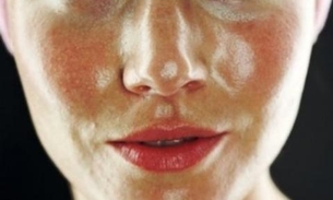 Saiba solucionar os principais problemas de pele que surgem no verão