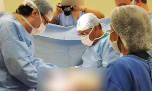 Homem morre de traumatismo craniano e rins são doados para dois no AM