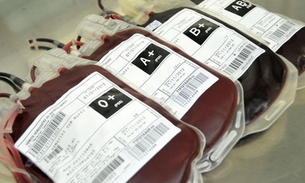   Paciente contrai HIV após transfusão com sangue contaminado