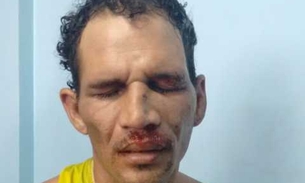 Homem leva 13 facadas de “amigo