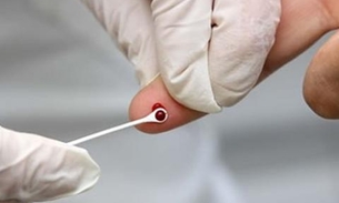 Autoteste para detecção do HIV estará disponível nas farmácias este ano