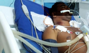 ​Empresário atropela motociclista e é acusado de não prestar socorro