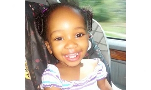 Menina de 4 anos tem danos cerebrais após anestesia inadequada de dentista