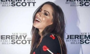 Anitta exagera no preenchimento labial e vira piada na internet